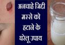 सिर्फ ये एक चीज आप के शरीर के सारे मस्से (Warts) हटा सकता है